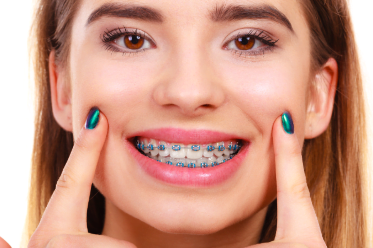impact of braces on your speech