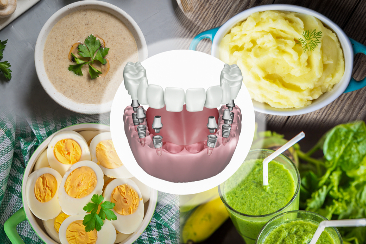 foods to eat after dental implants