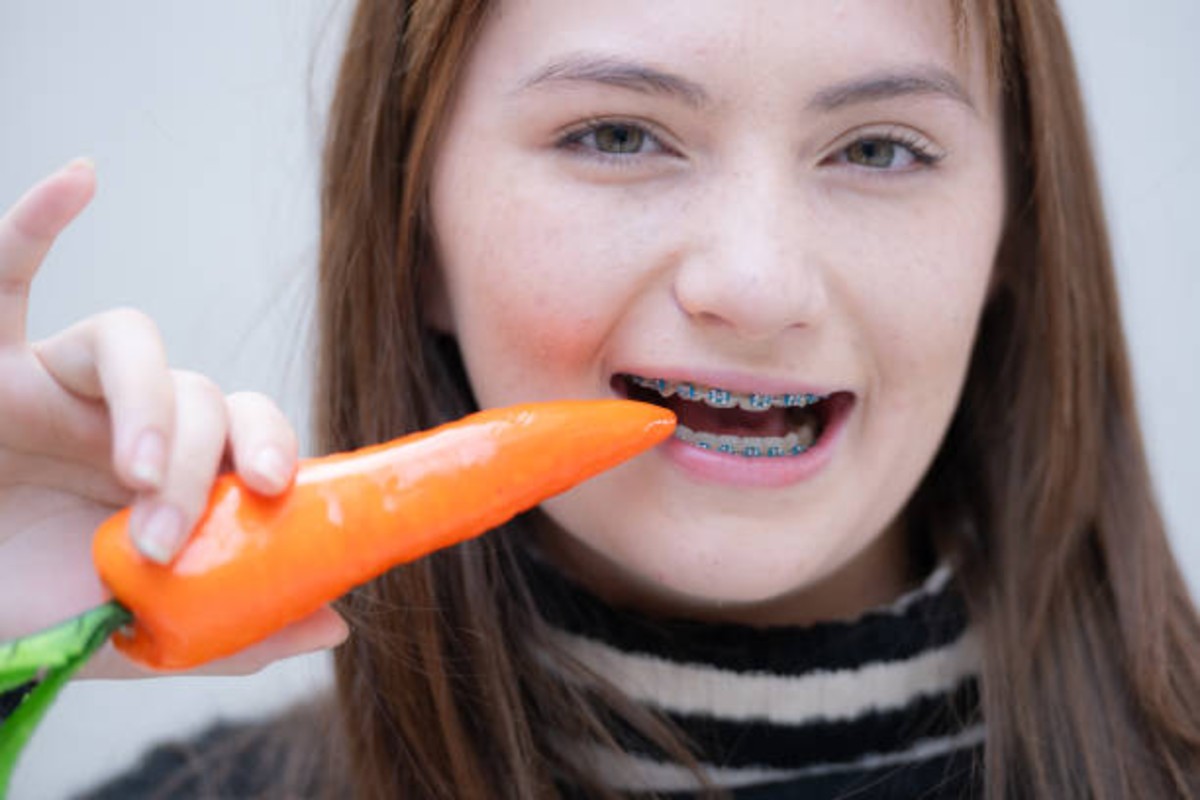 Foods to avoid with braces