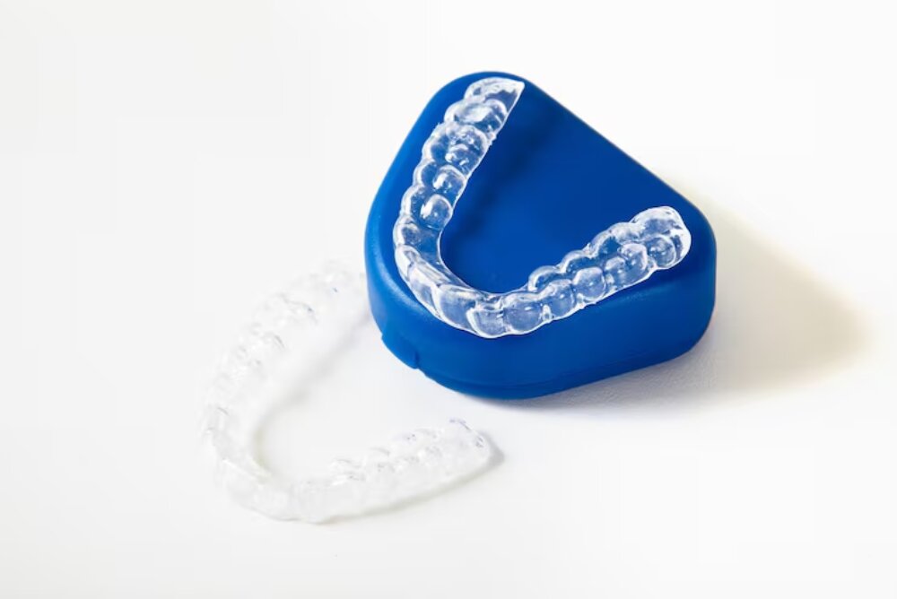 custom mouth guard for oral protection and comfort