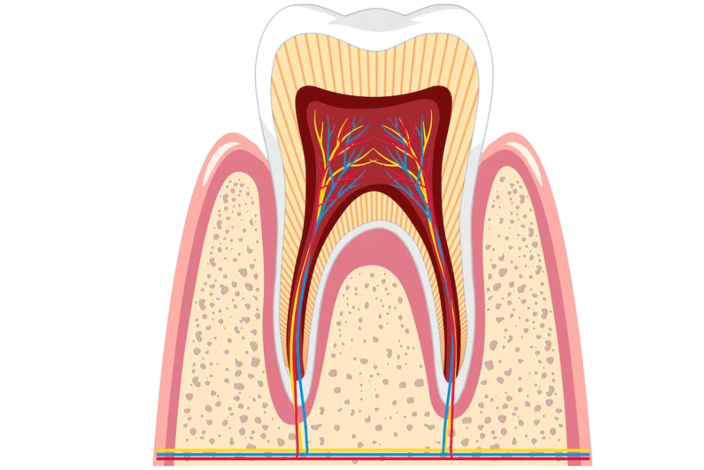 root canal treatment illustration showing infected tooth and inner nerve canals